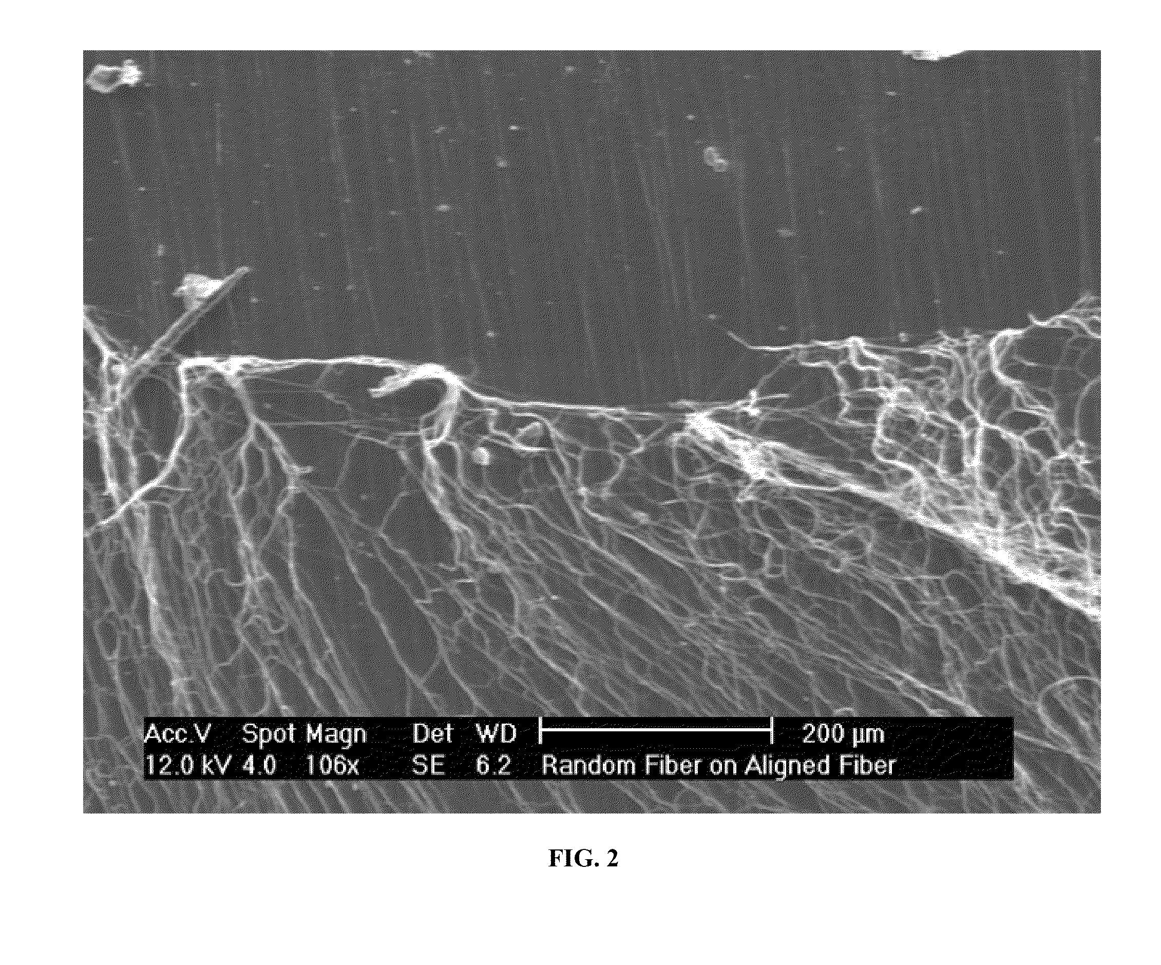 System for manufacturing fiber scaffolds for use in tracheal prostheses