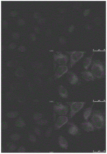 Indocyanine green composite nanoparticle as well as preparation method and application thereof
