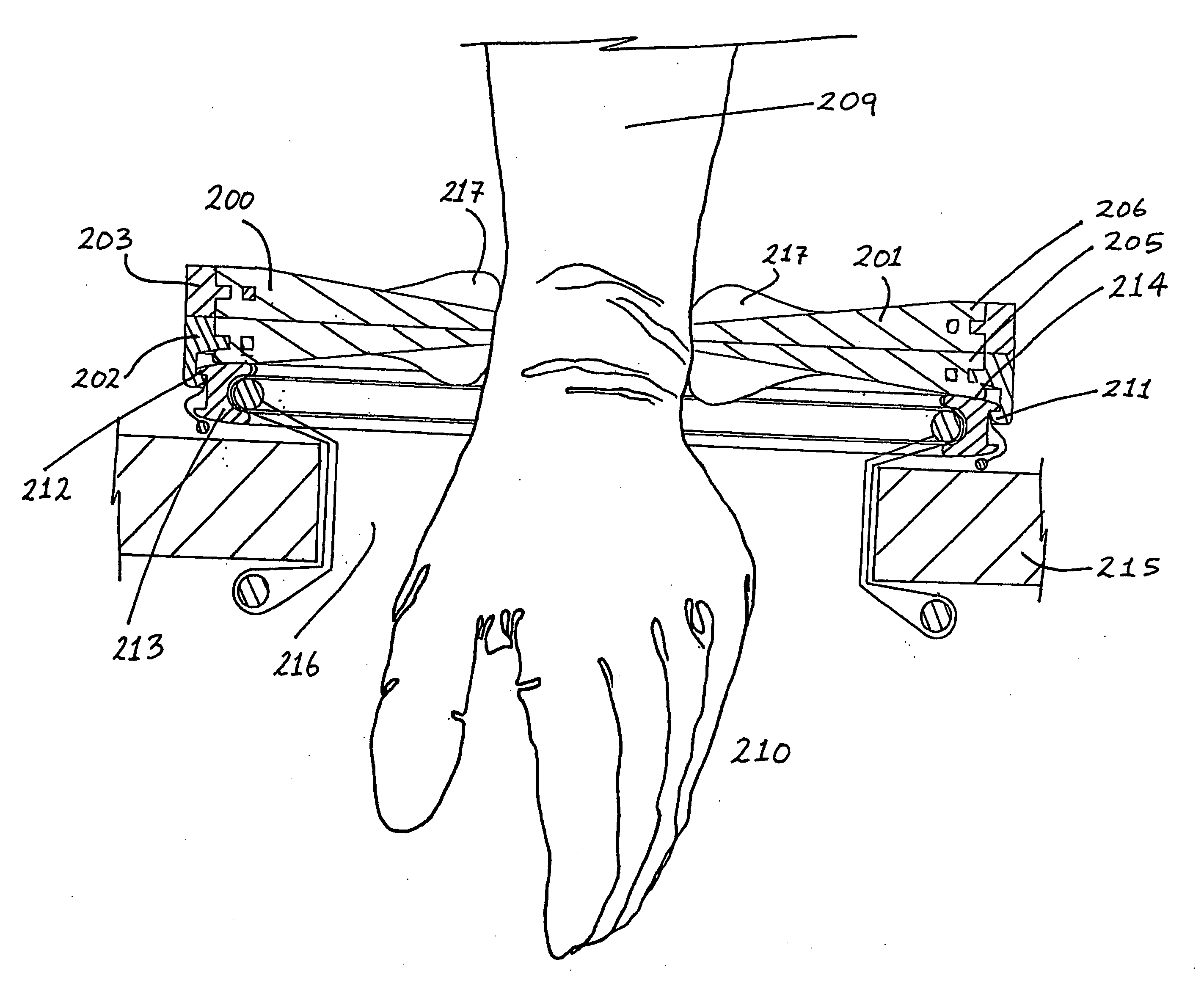 Surgical sealing device
