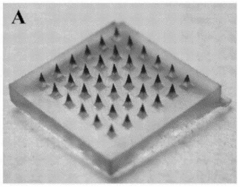 Anti-depression sleep-aiding autolytic microneedle patch and preparation method thereof