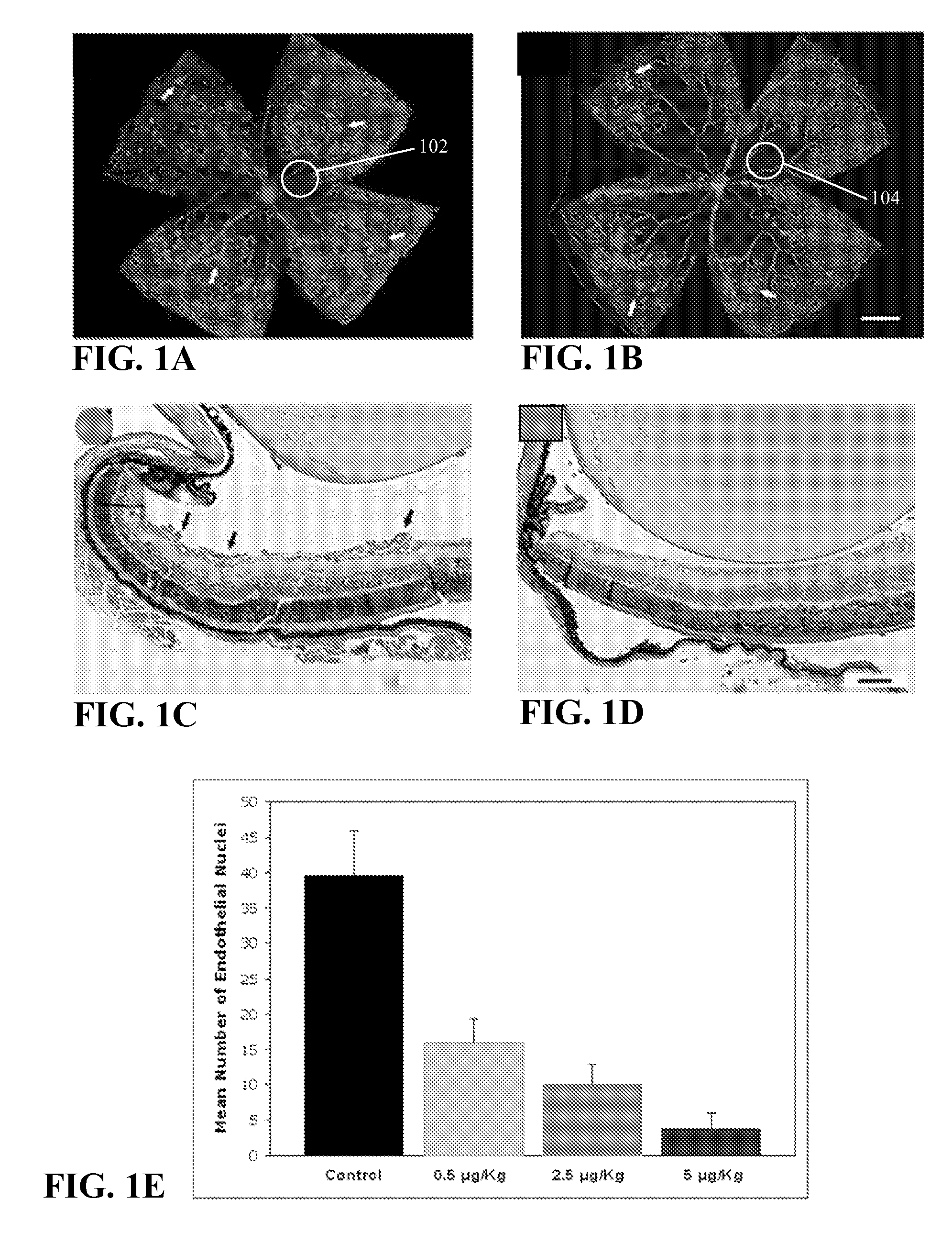 Method of using calcitriol for treating intraocular diseases associated with angiogenesis