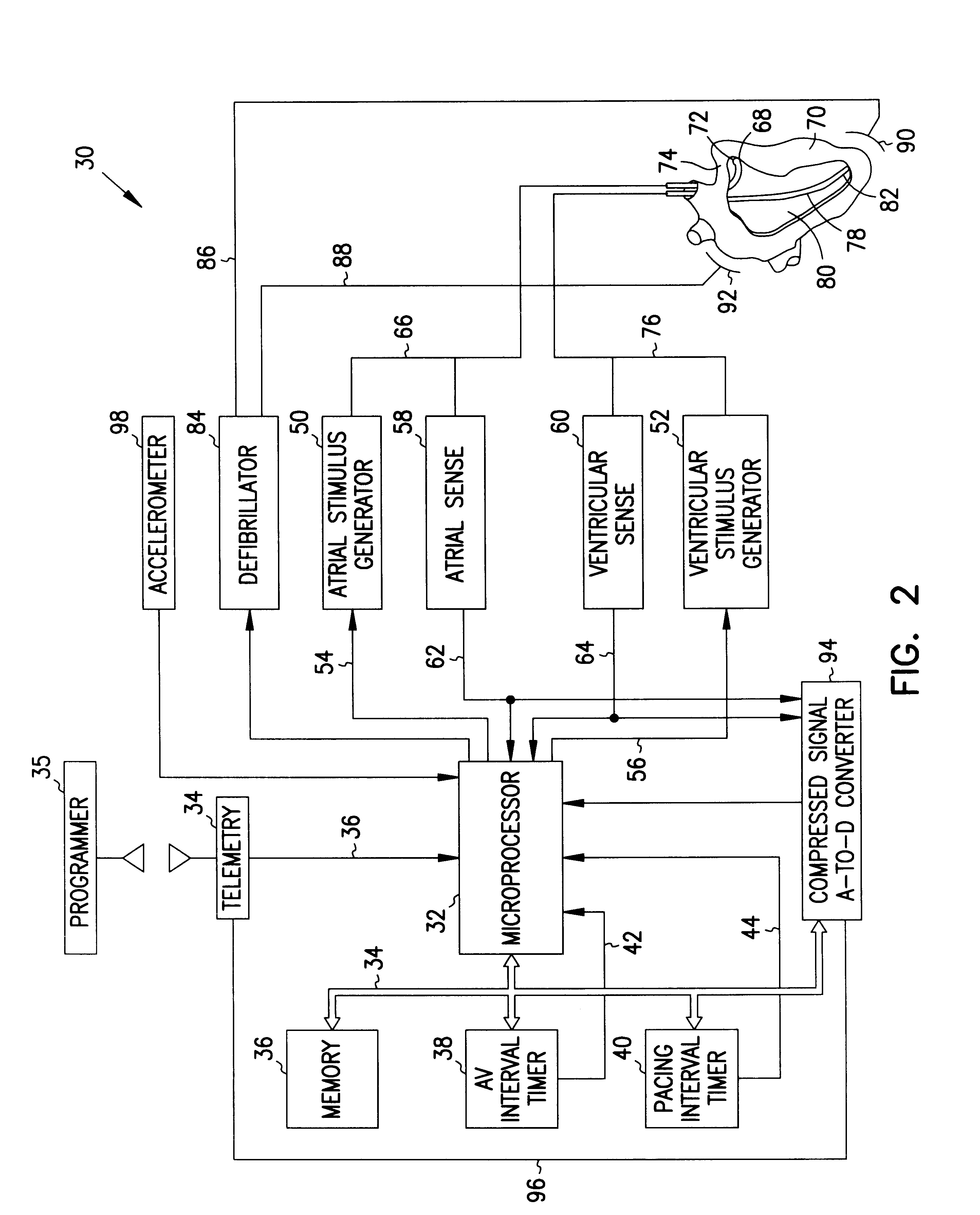 Methods and apparatus for tachycardia rate hysteresis for dual-chamber cardiac stimulators