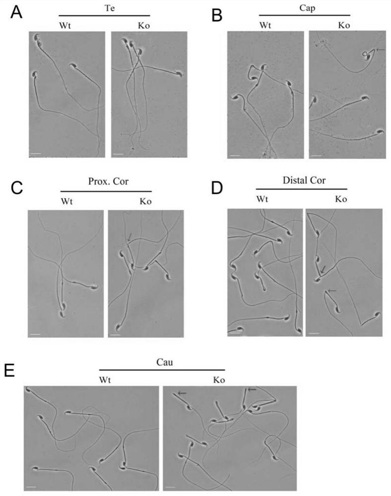 Application of emc10 protein as a biomarker in the diagnosis of male infertility