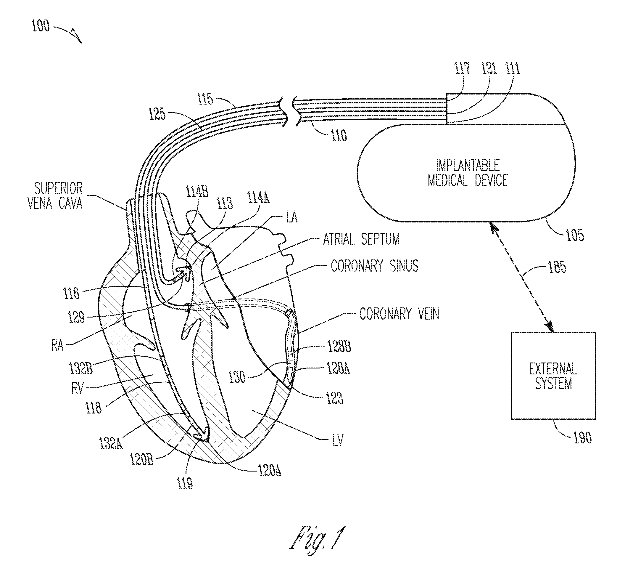 Method and apparatus for controlling cardiac therapy using ultrasound transducer