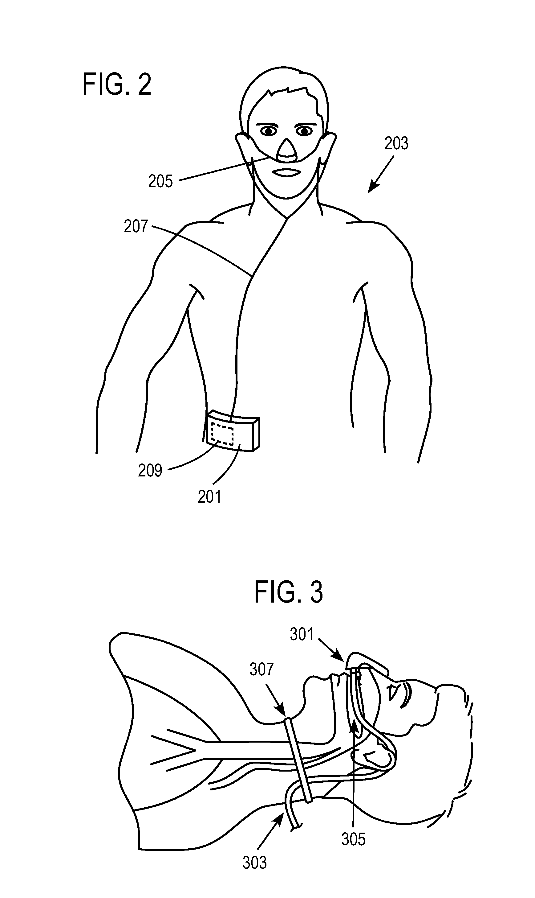 Methods, systems and devices for non-invasive open ventilation for providing ventilation support