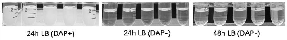 Construction of PP2 strict anaerobic salmonella strain and application of PP2 strict anaerobic salmonella strain in tumor treatment