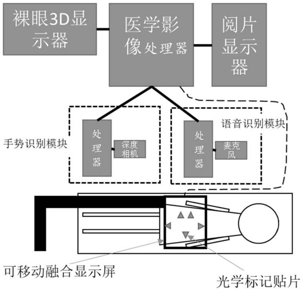 Medical image-based intraoperative auxiliary display method and device and storage medium