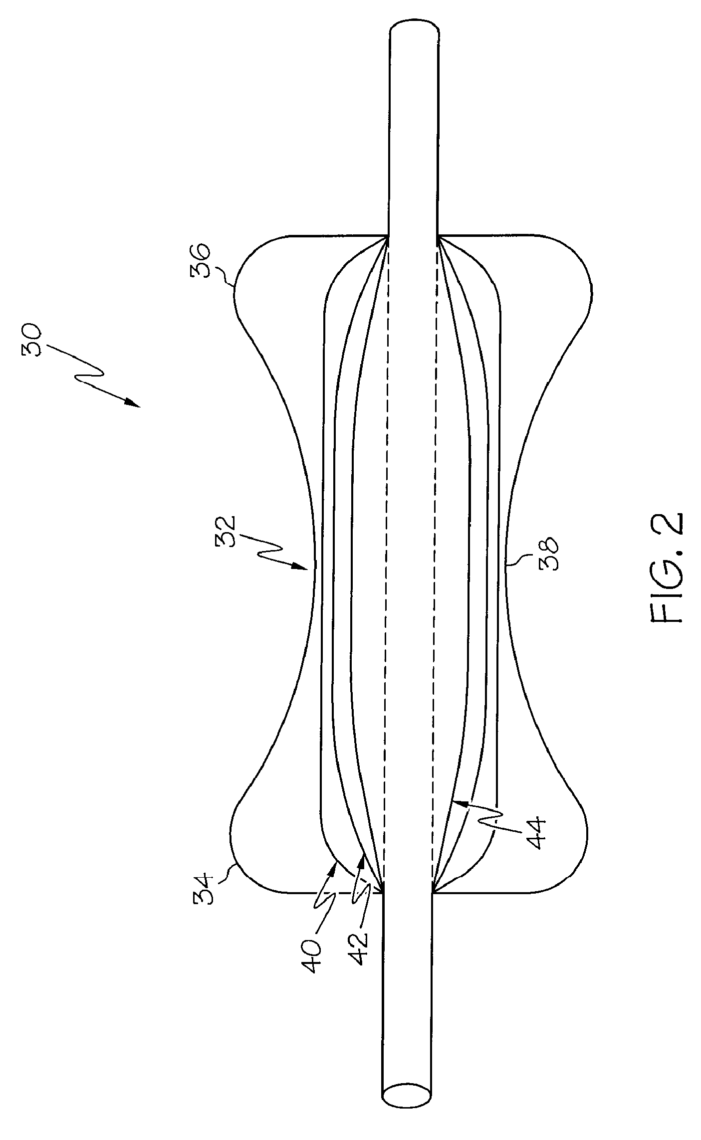 Airway Balloon Dilator