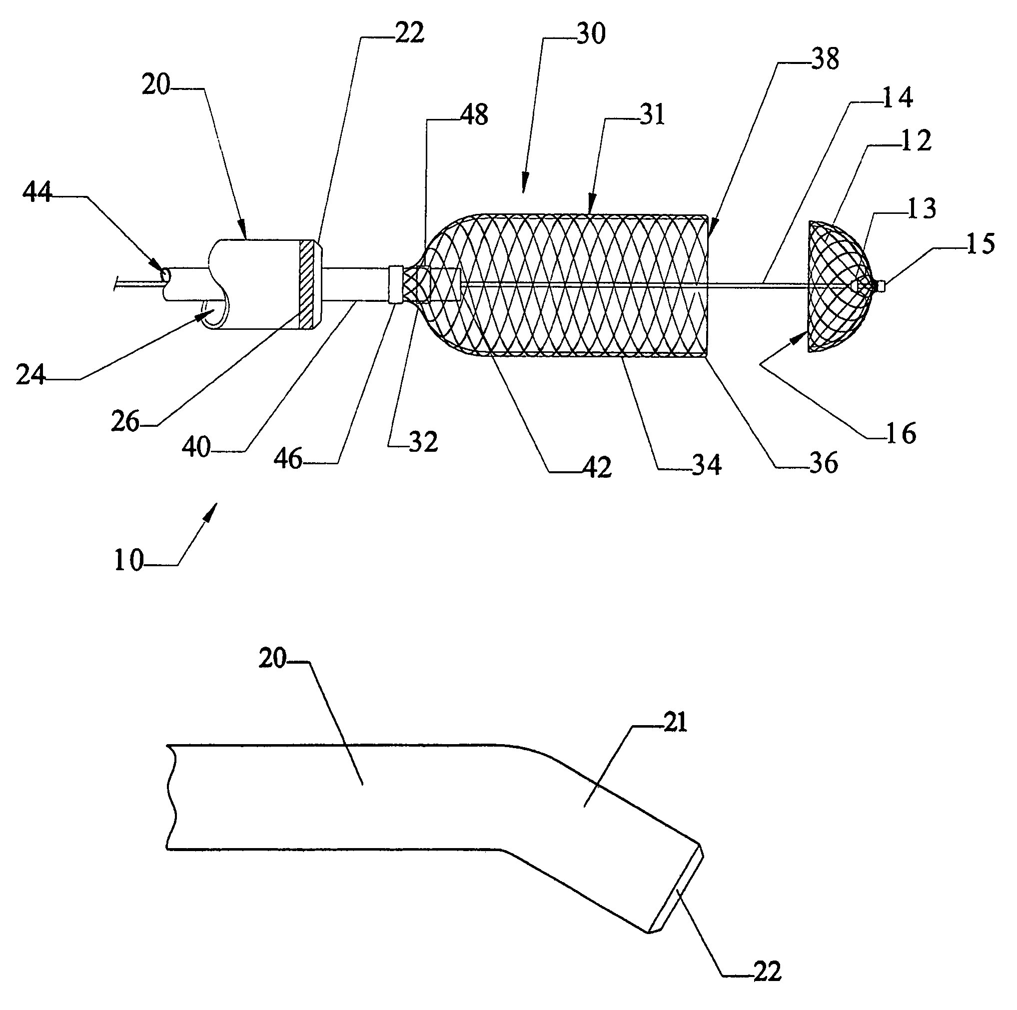 Minimally invasive medical device deployment and retrieval system