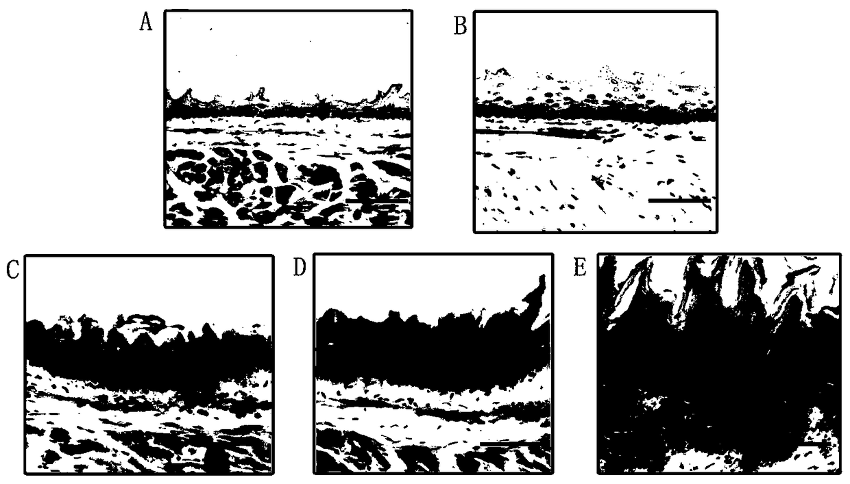 Method for constructing esophageal epithelial tissue p53 specific knockout mouse esophageal precancerous lesion model