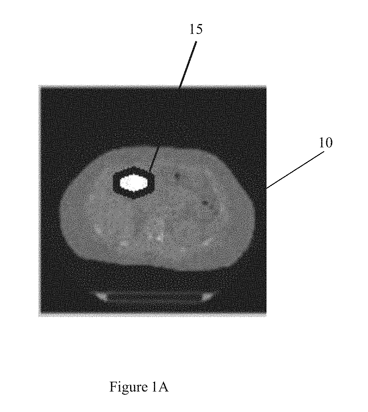 Method for Fiducialless Real-time Tracking in Radiation Treatment of Abdominal Tumors