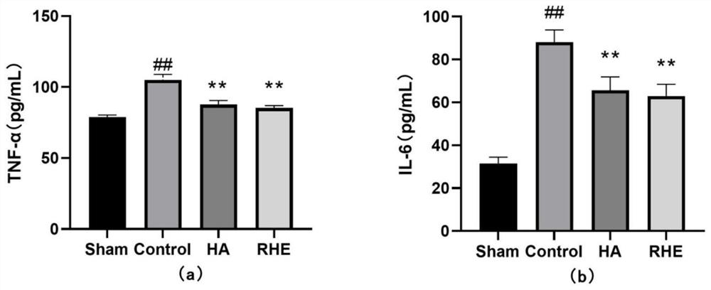 Medicine for treating postoperative abdominal adhesion, and new use of medicine