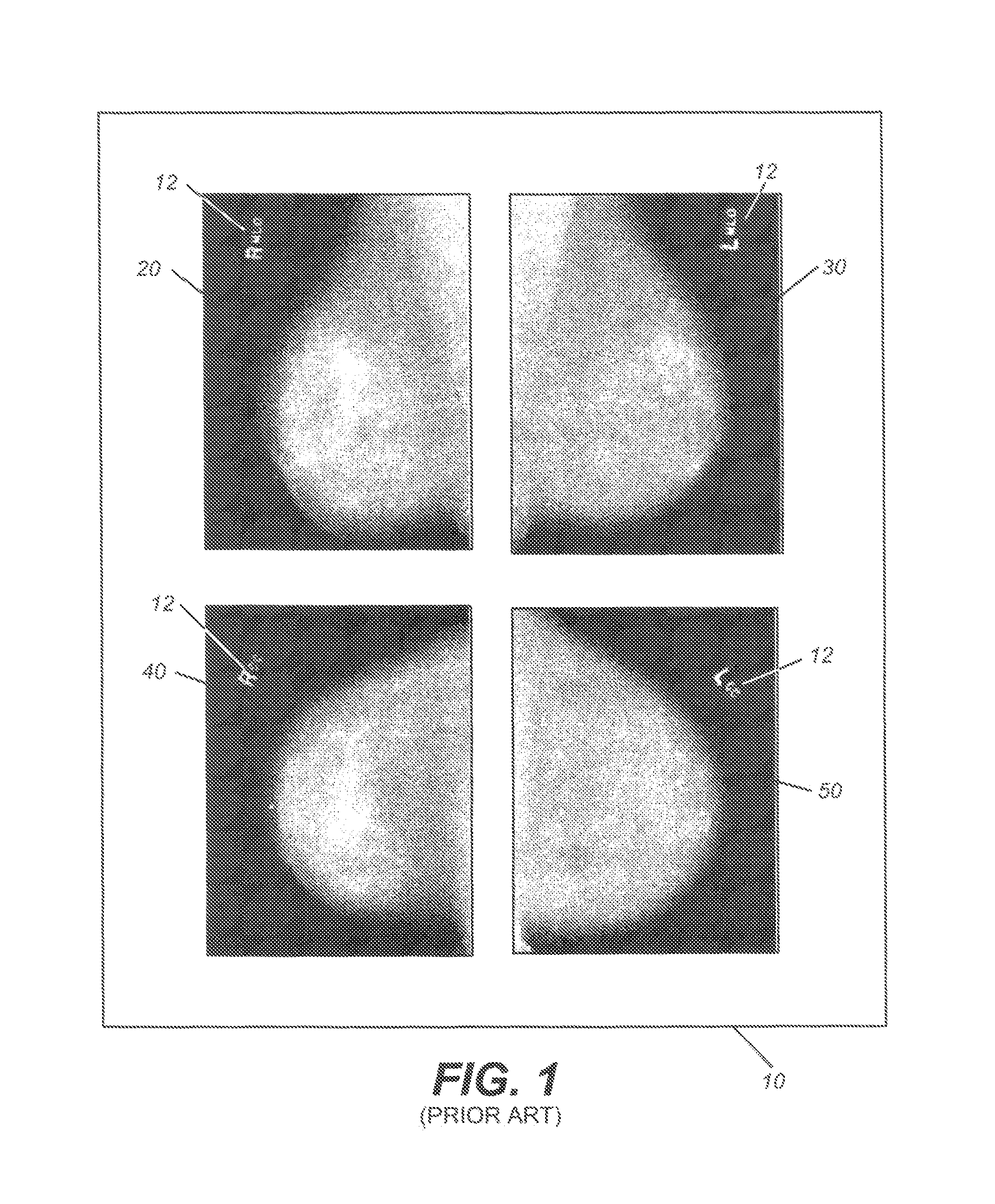 Method for classifying breast tissue density using computed image features