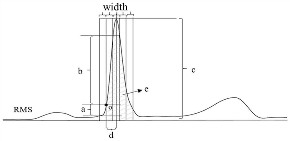 A method for detecting the starting point of qrs complex of multi-lead electrocardiographic signal