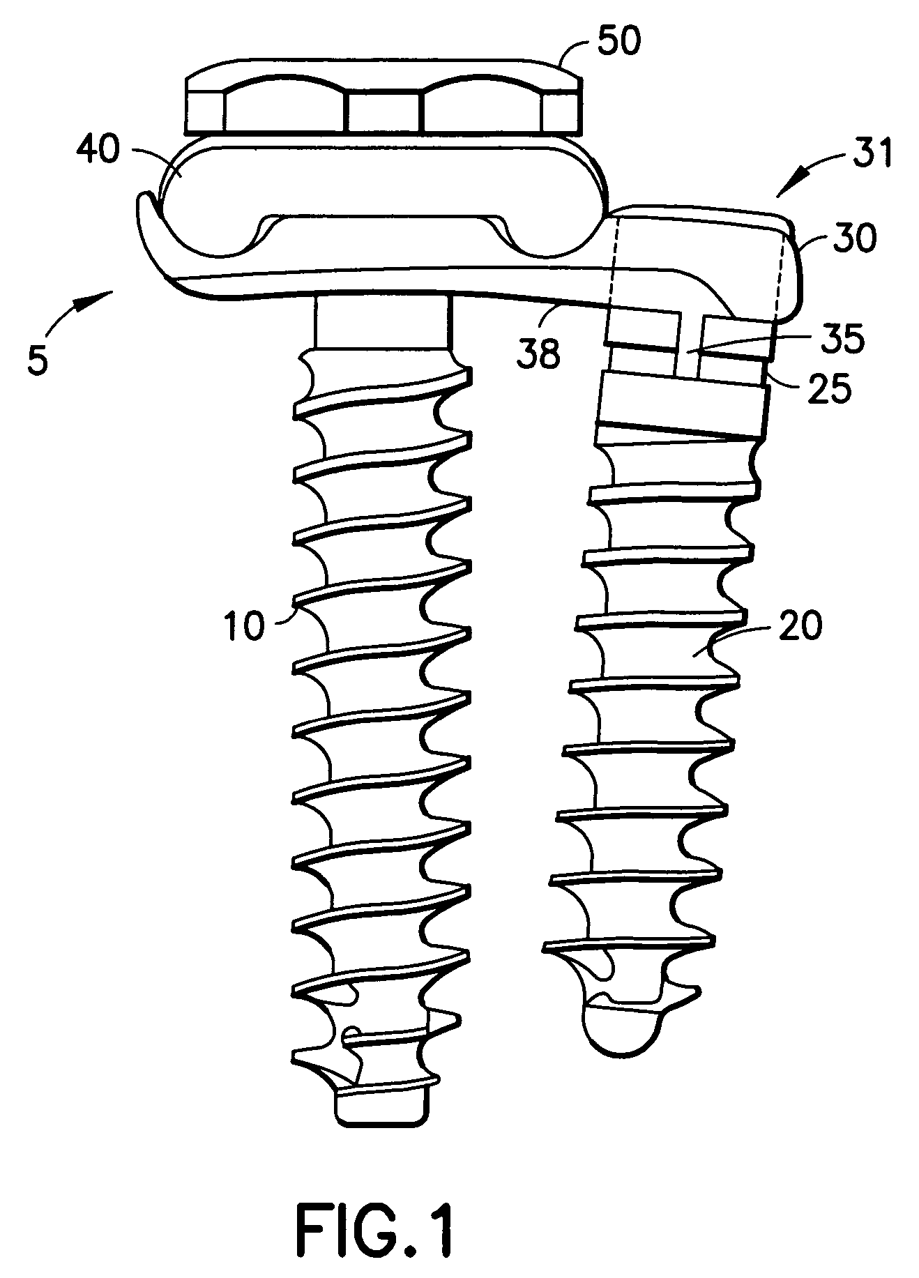 Locking mechanism for a bone screw