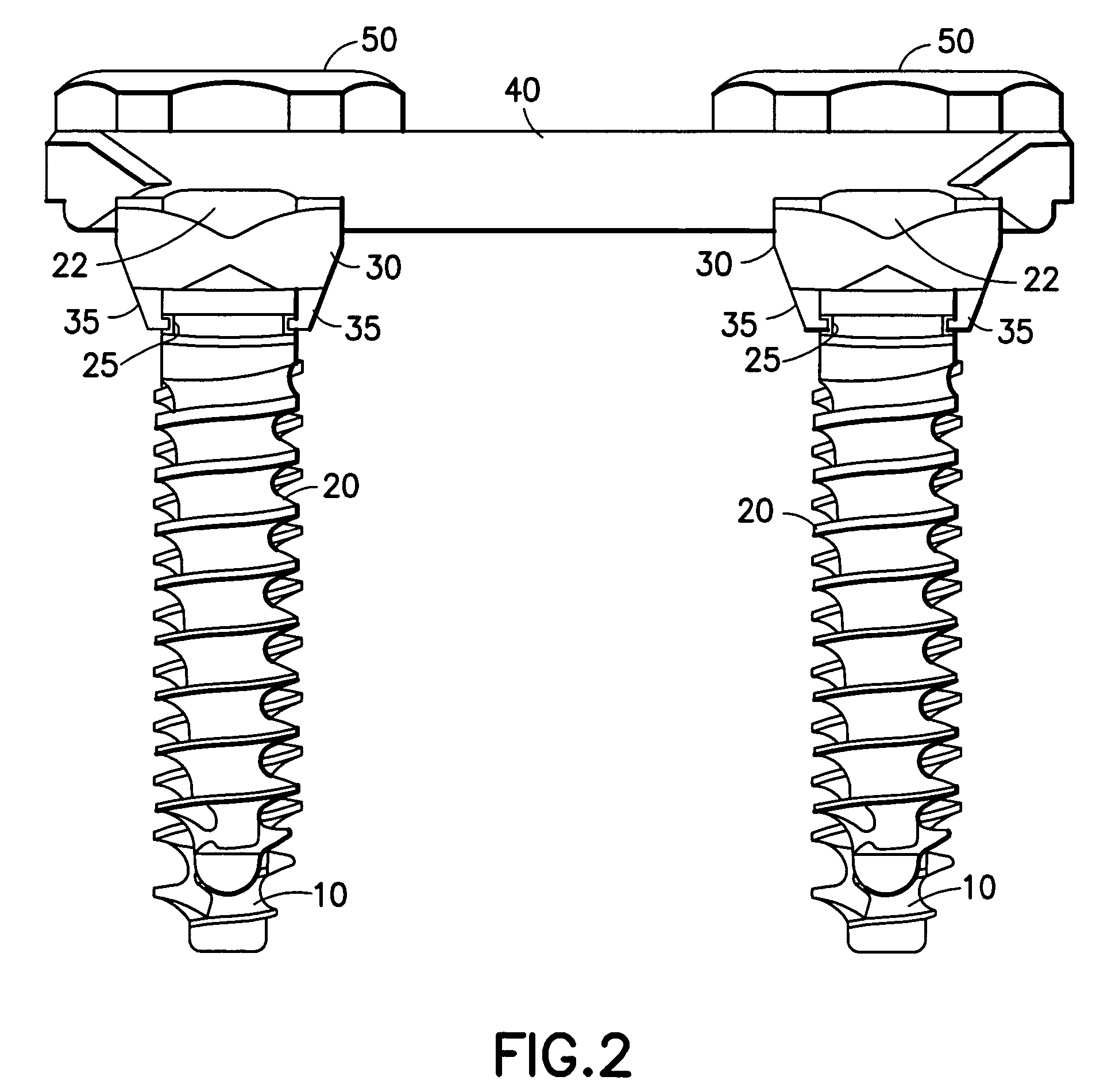 Locking mechanism for a bone screw