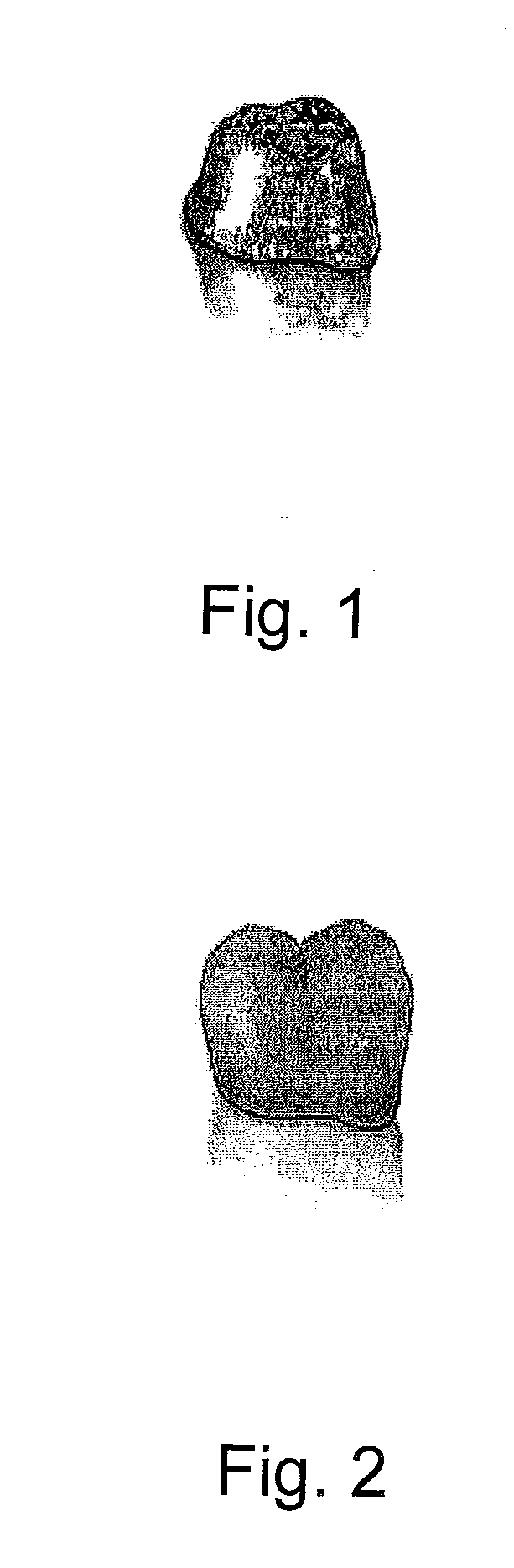 Method of making dental prosthesis and ductile alloys for use therein