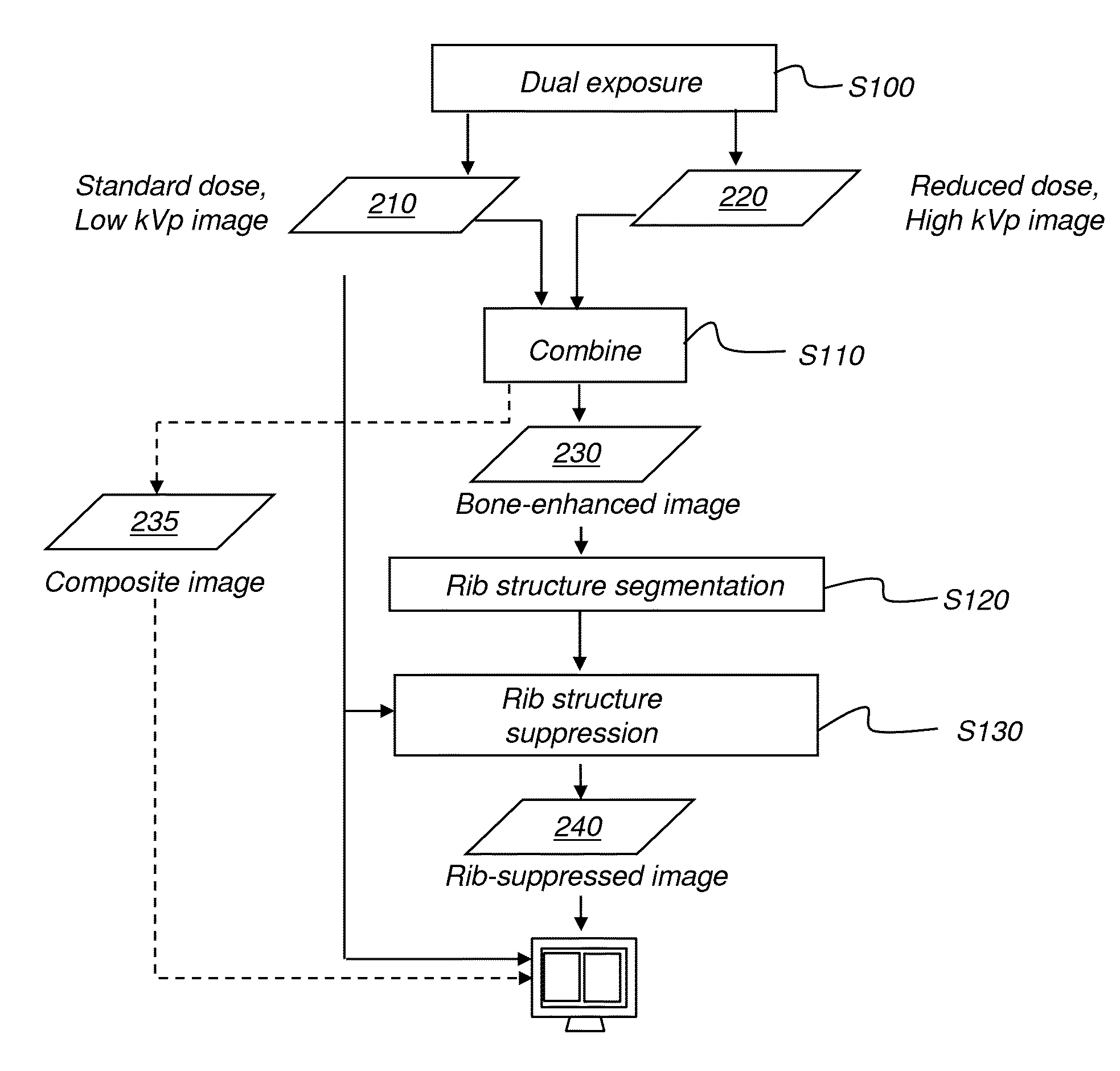 Hybrid dual energy imaging and bone suppression processing