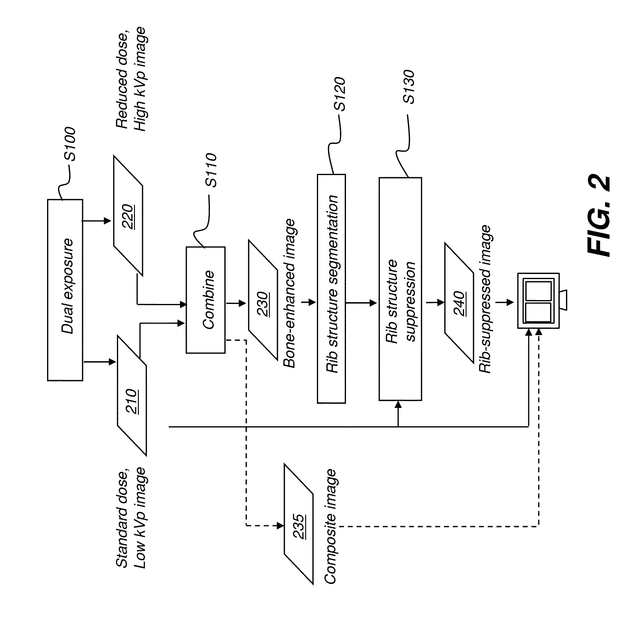 Hybrid dual energy imaging and bone suppression processing