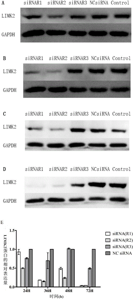 Bone cell LIMK2 gene and novel application of expression products of bone cell LIMK2 gene