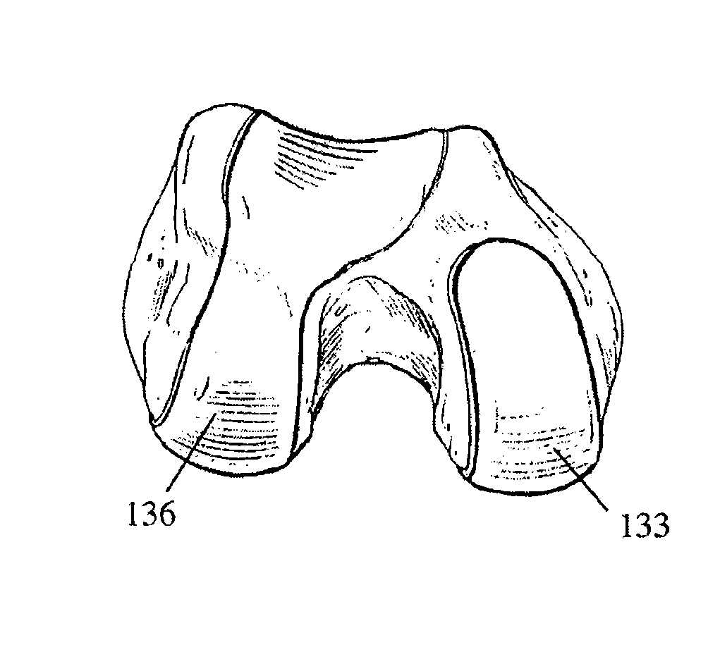 Bicompartmental implants and method of use