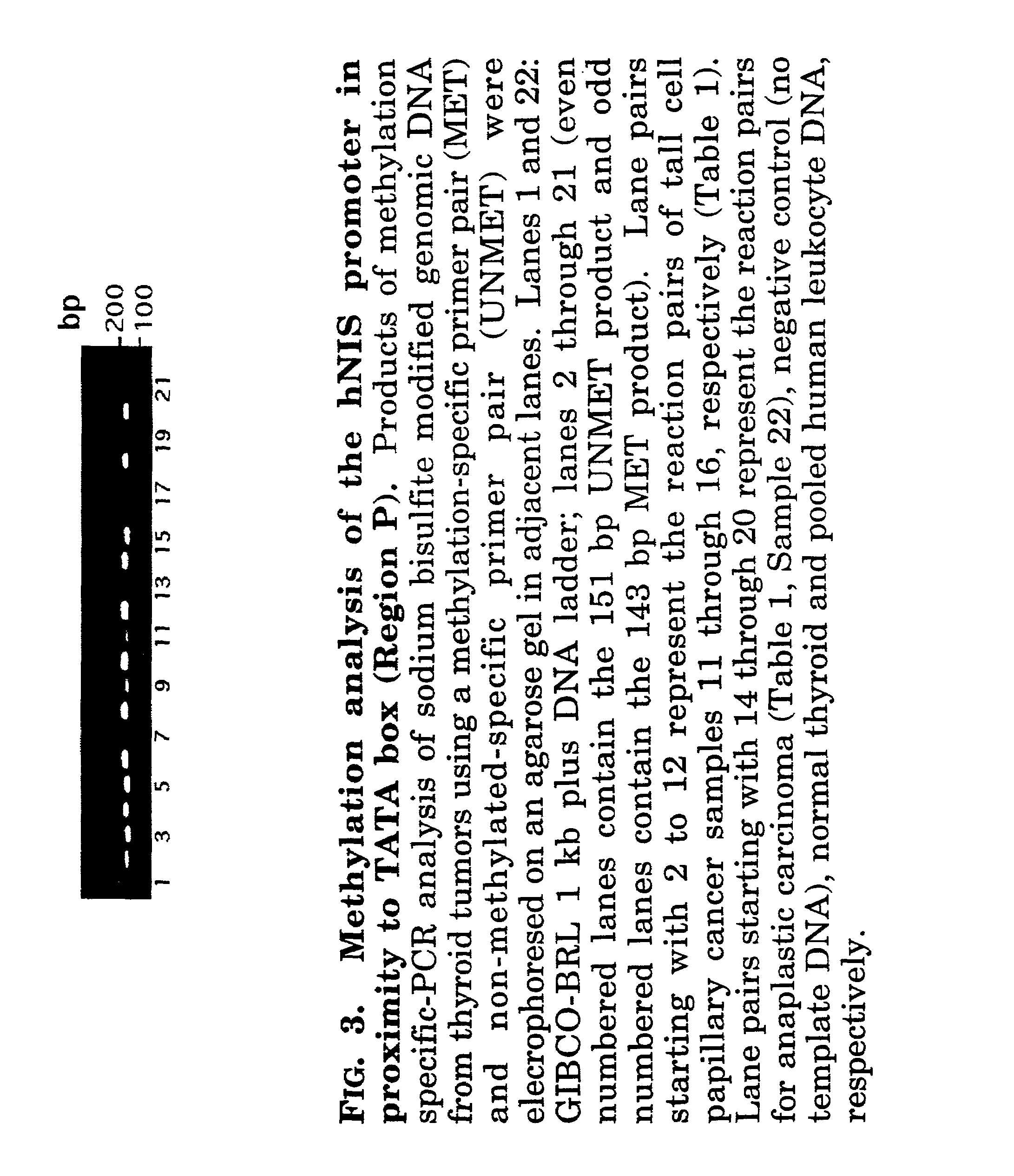 Iodine uptake restoration in thyroid cancer