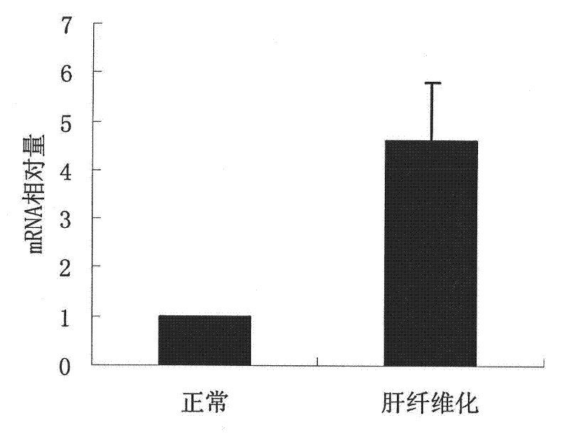 Application of nadh dehydrogenase flavoprotein 2 in the preparation and detection of drugs