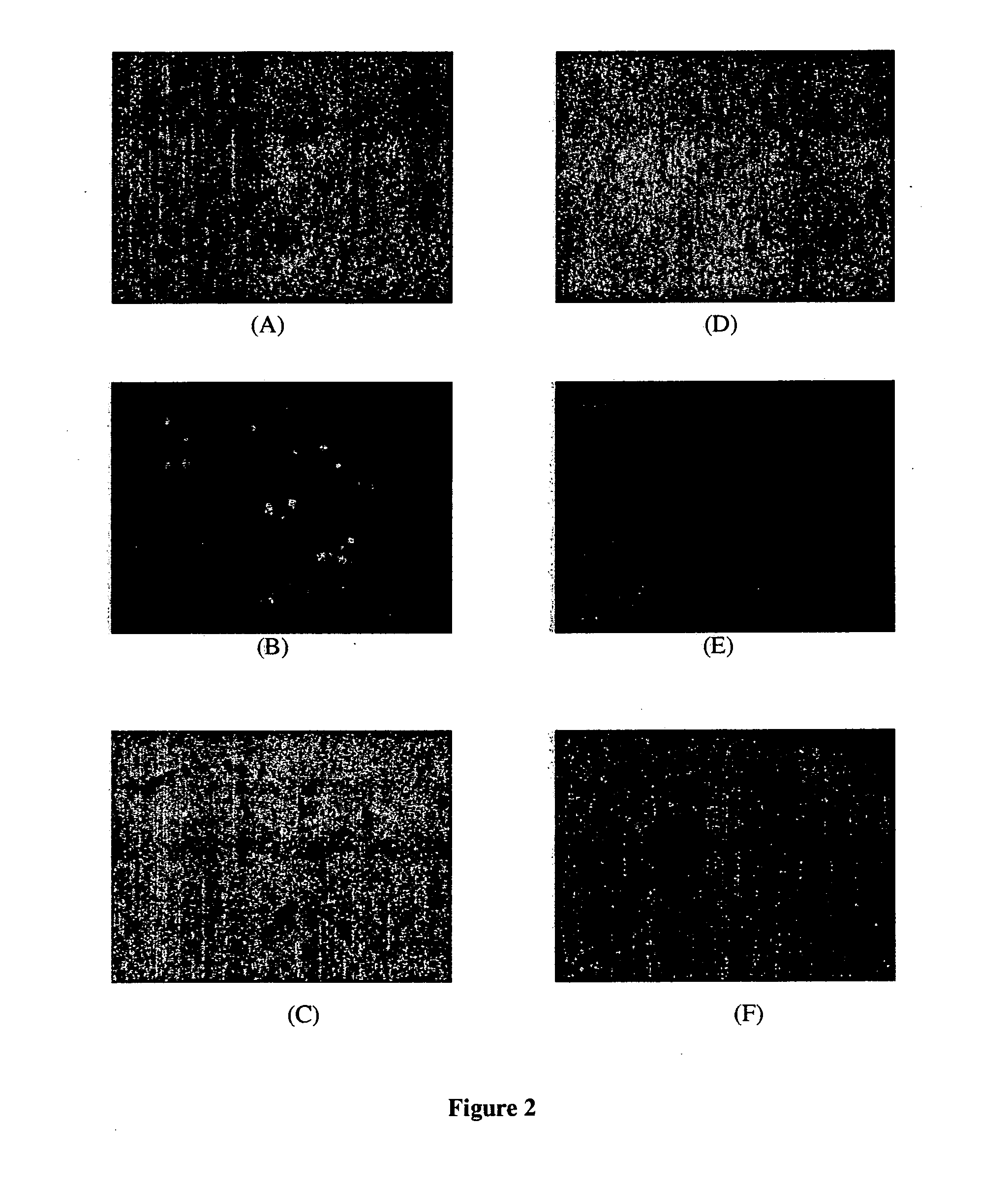 Amphoteric liposomal compositions for cellular delivery of small RNA molecules for use in RNA interference