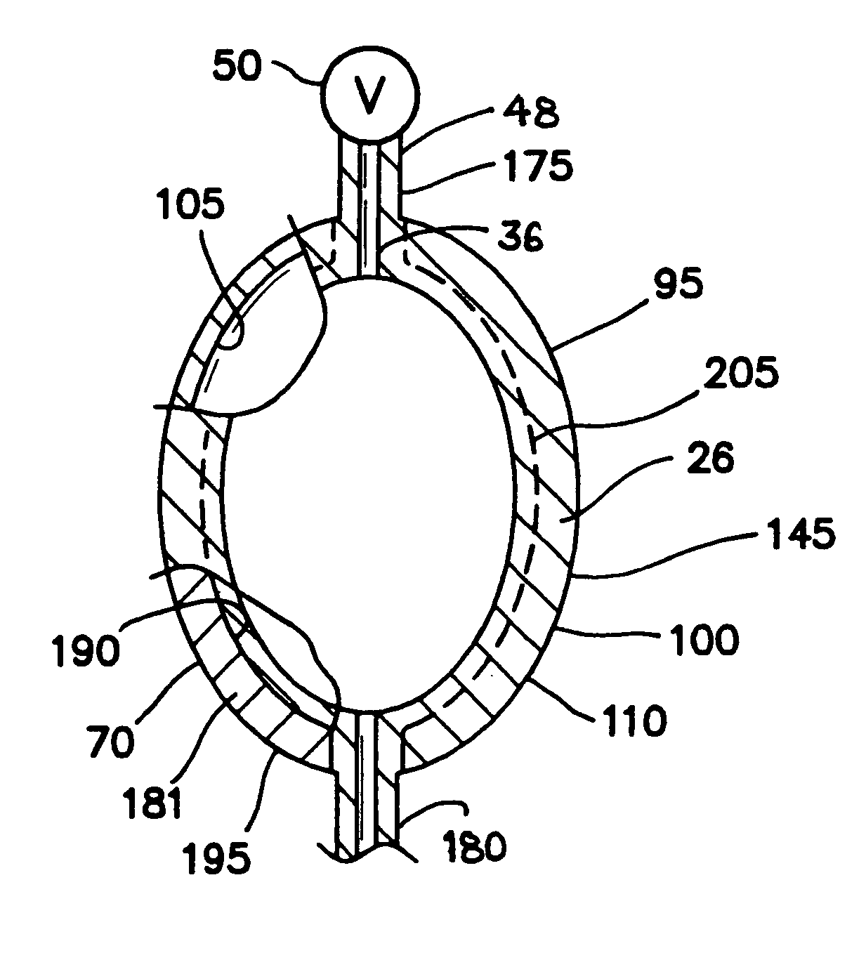 Ovoid flexible pressure vessel, apparatus and method for making same