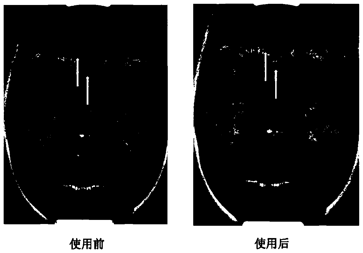 Whitening composition and method for preparing microemulsion type cosmetics