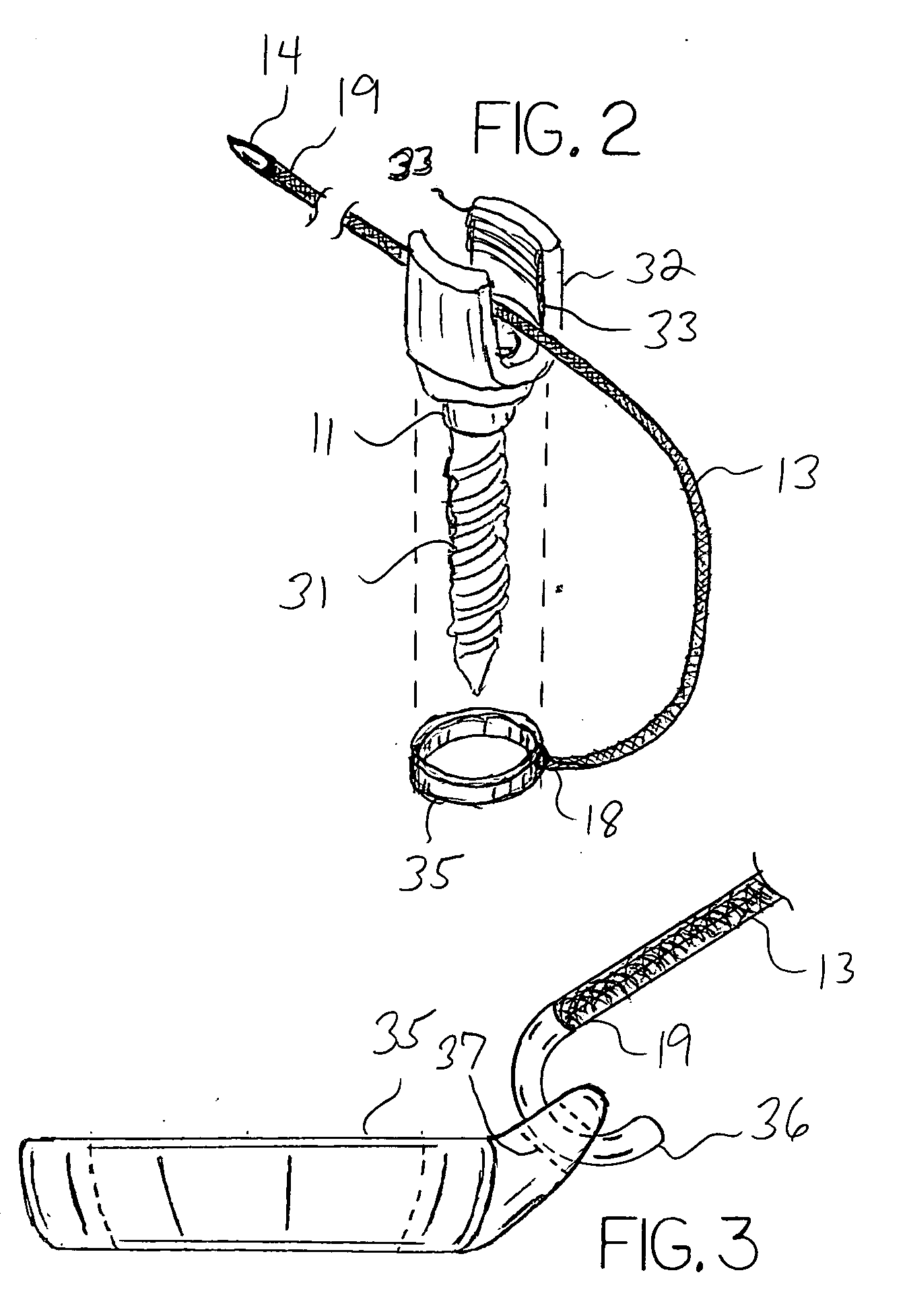 Guide wire mounting collar for spinal fixation using minimally invasive surgical techniques