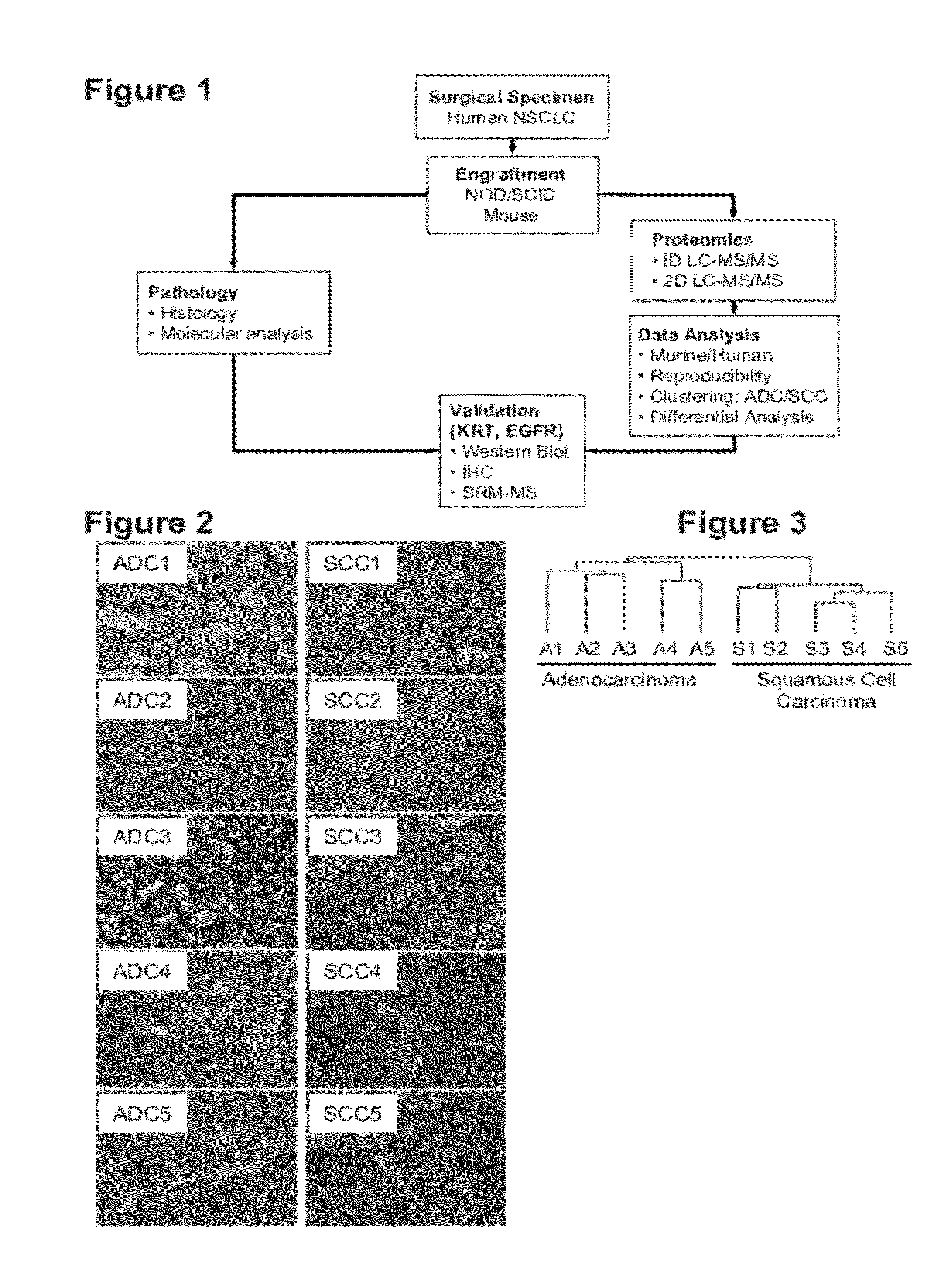 Methods and compositions for the classification of non-small cell lung carcinoma