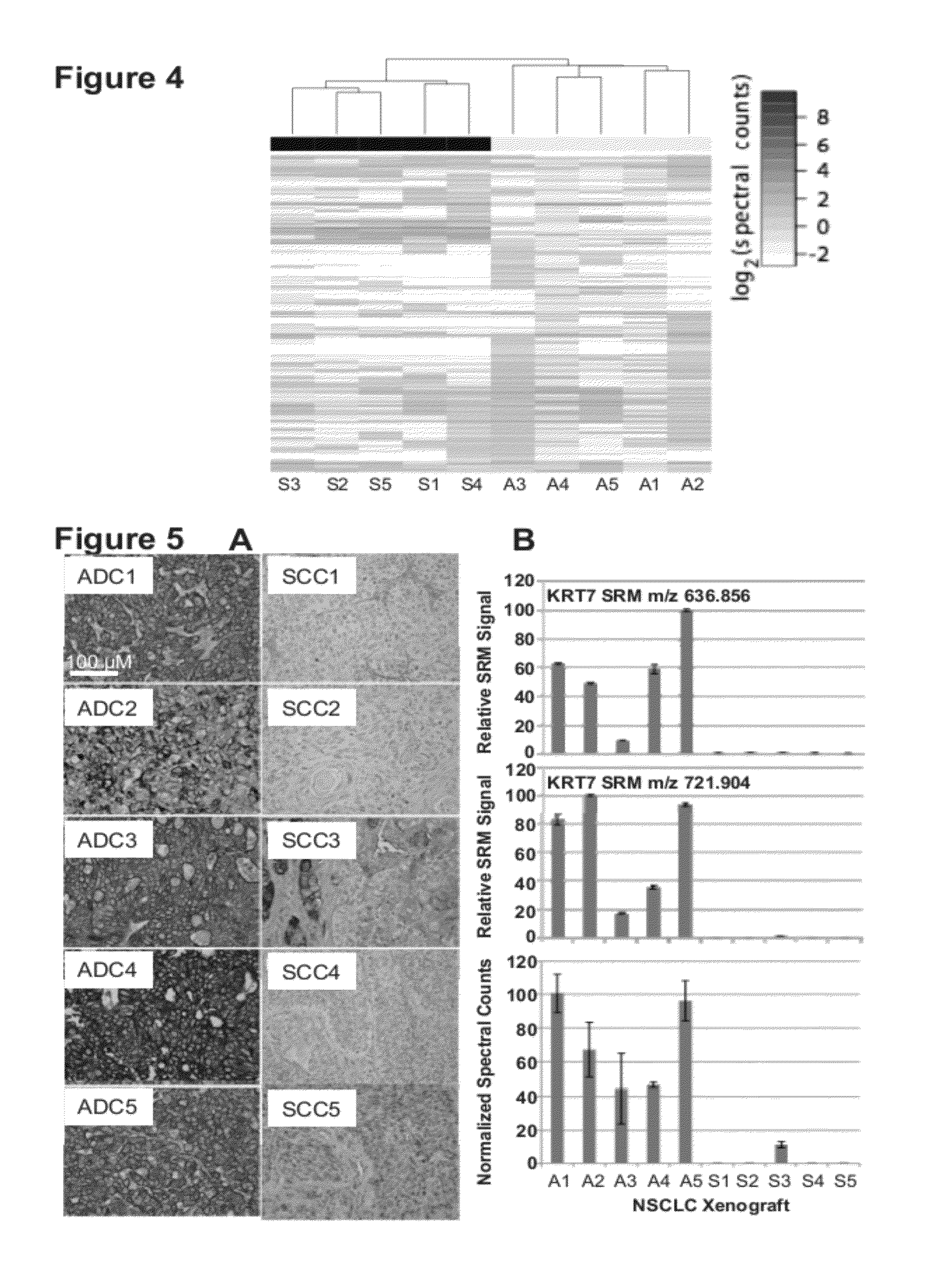 Methods and compositions for the classification of non-small cell lung carcinoma