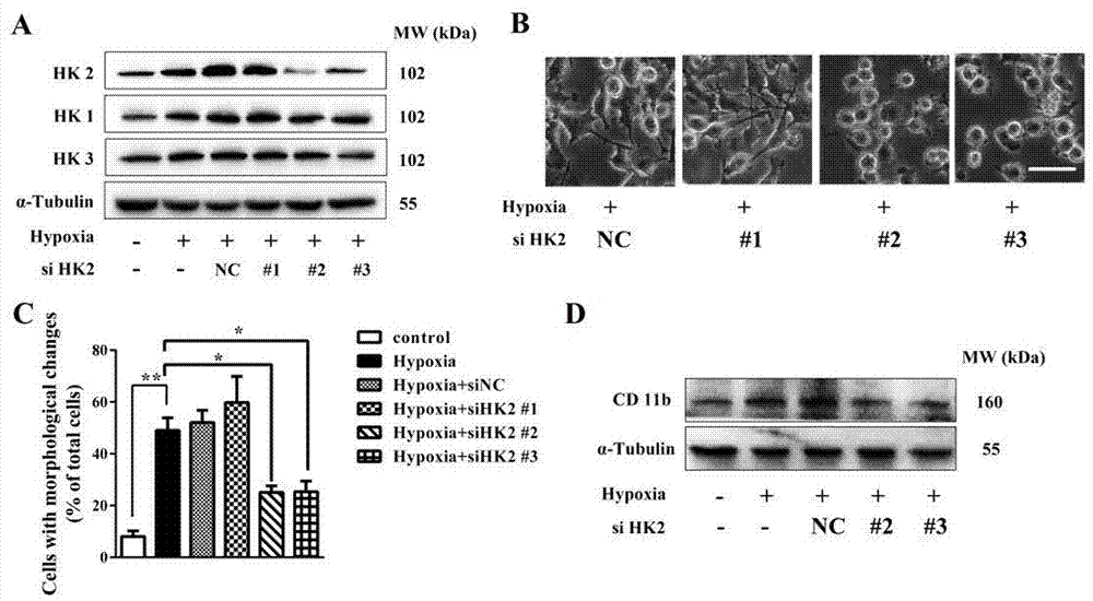 Application of hexokinase 2-specific inhibitor in acute central nervous system injury diseases
