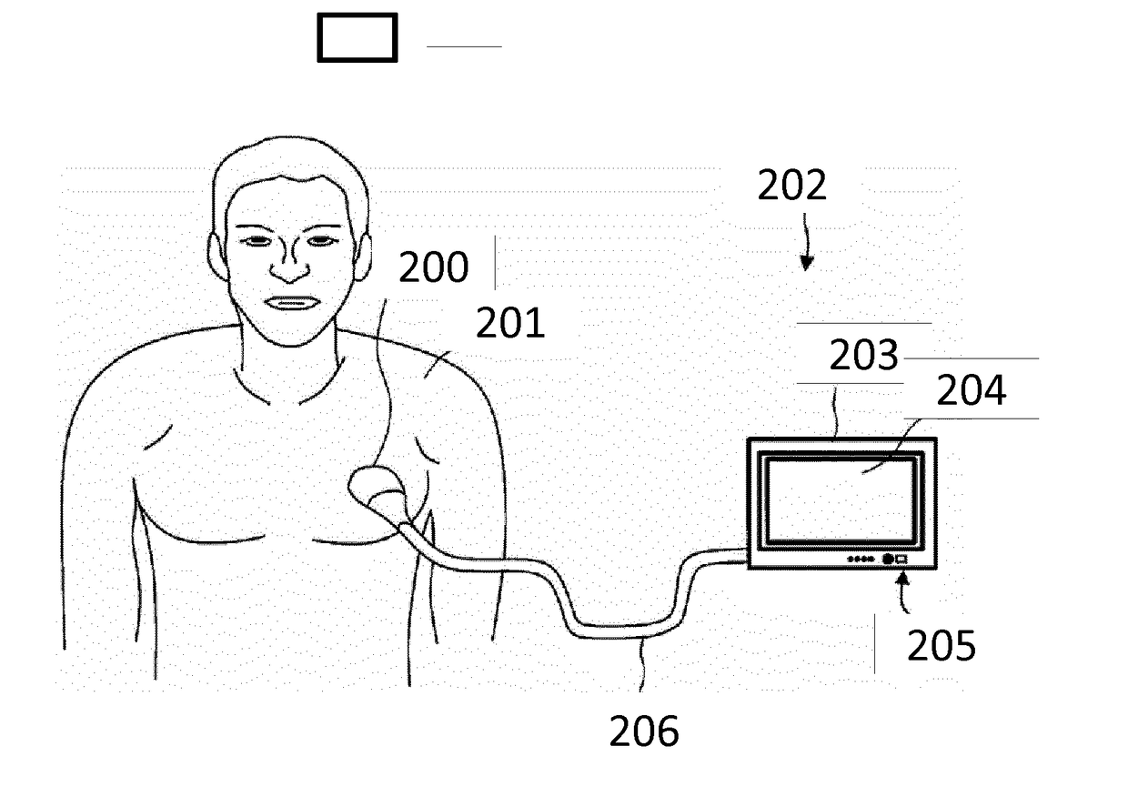 Cmut array comprising an acoustic window layer