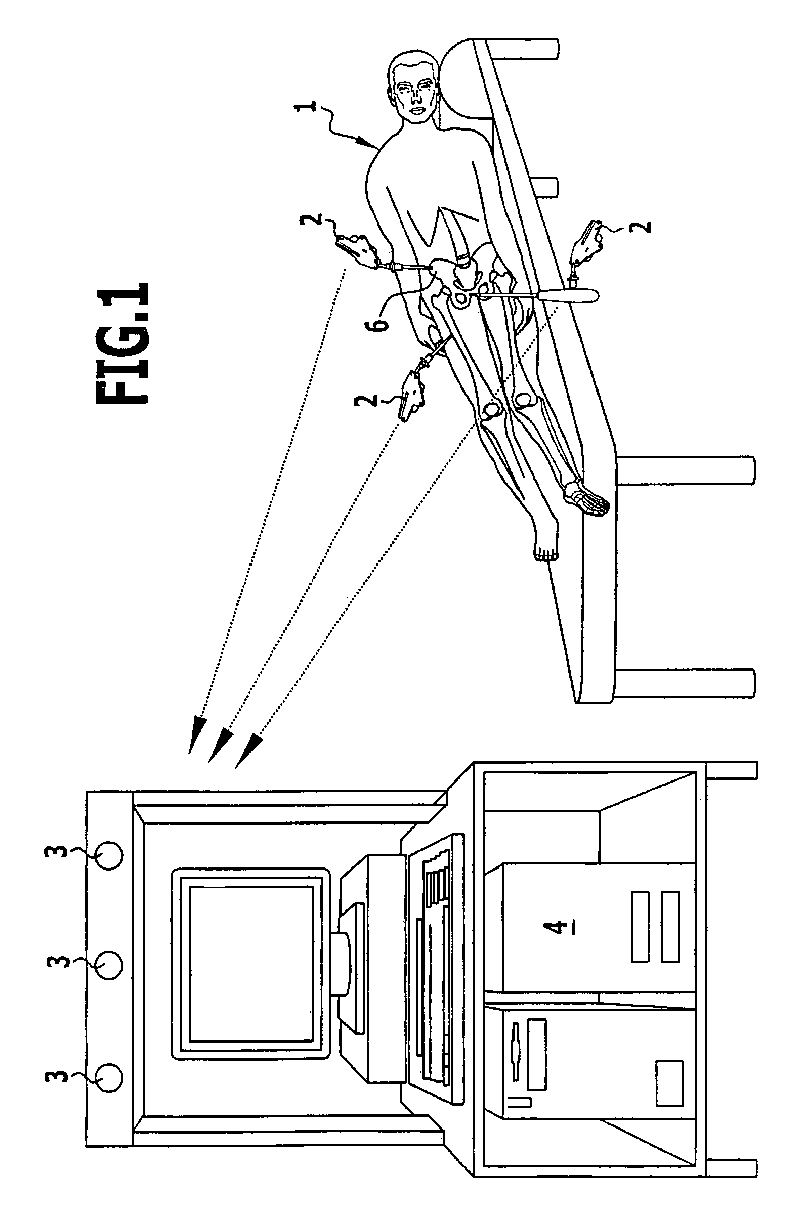 Method and surgical navigation system for creating a recess to receive an acetabulum