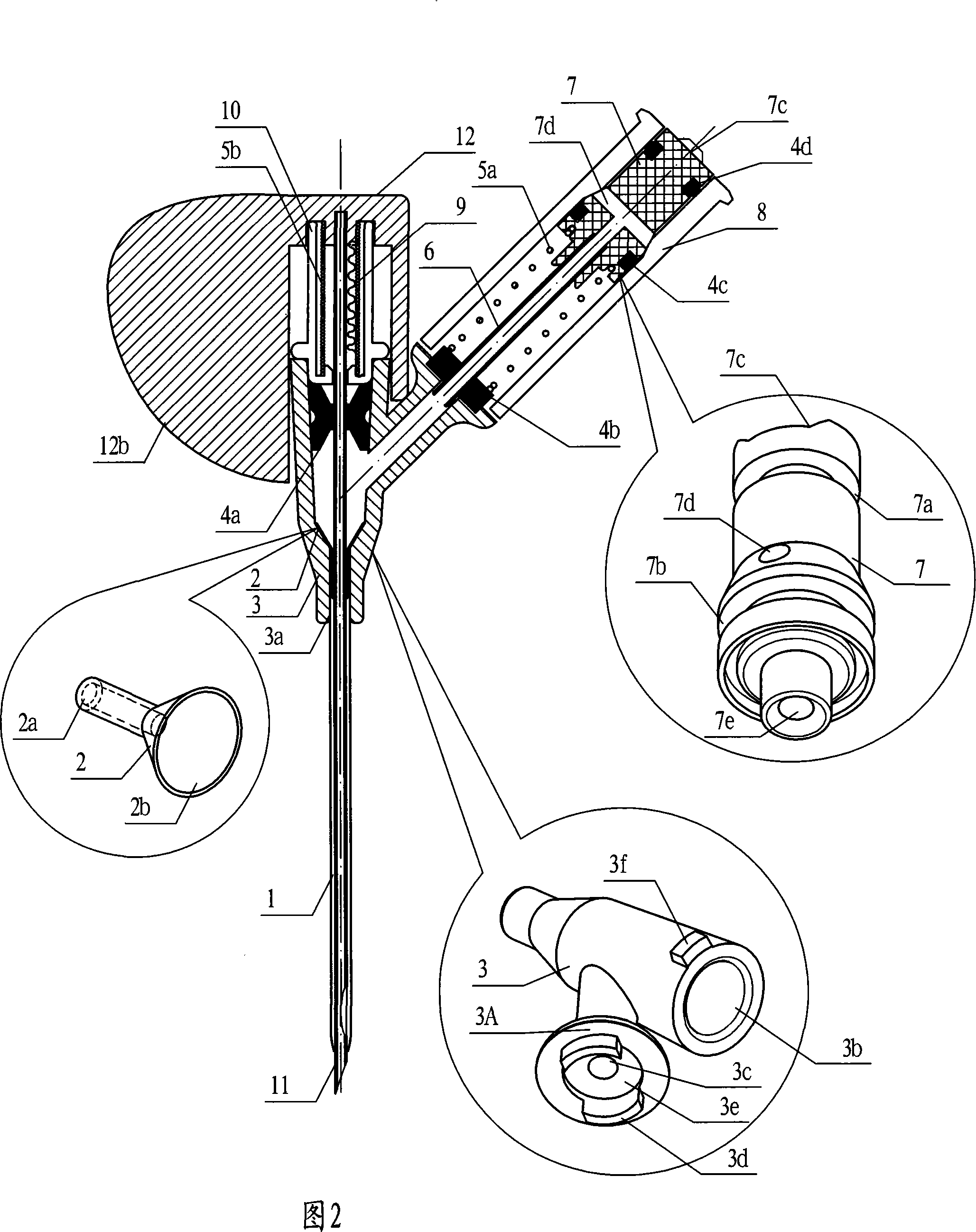 Y-type safe arteriovenous remaining needle with needle-free interface plus pressure closed-type valve