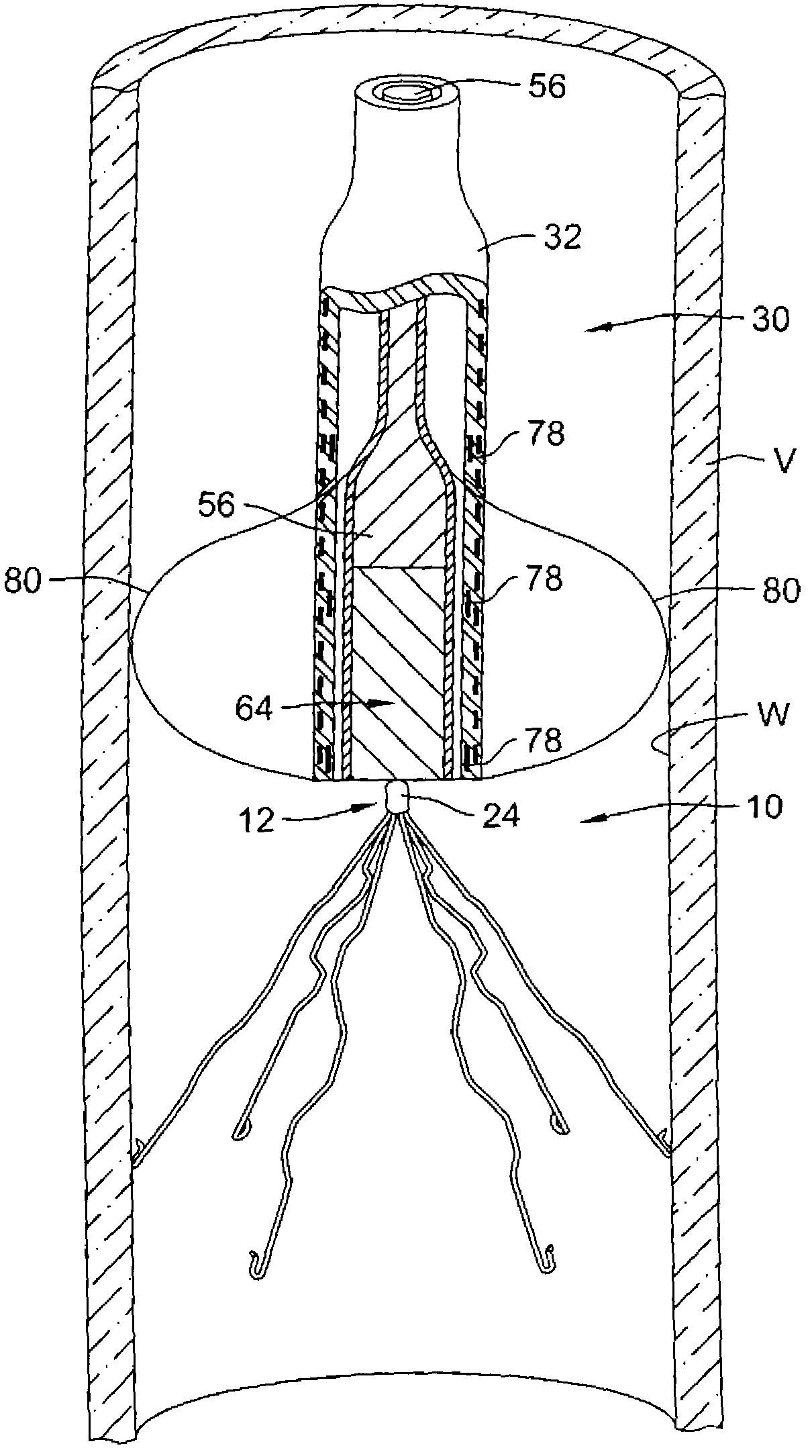 Devices and methods for magnetically manipulating intravascular devices