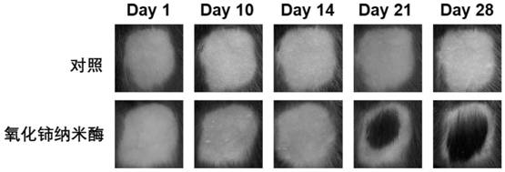 Application of cerium oxide nano-enzyme with active oxygen scavenging capacity in treatment of alopecia