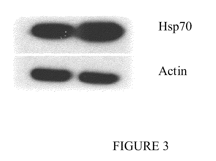 Indole compounds and their use as radiation sensitizing agents and chemotherapeutic agents