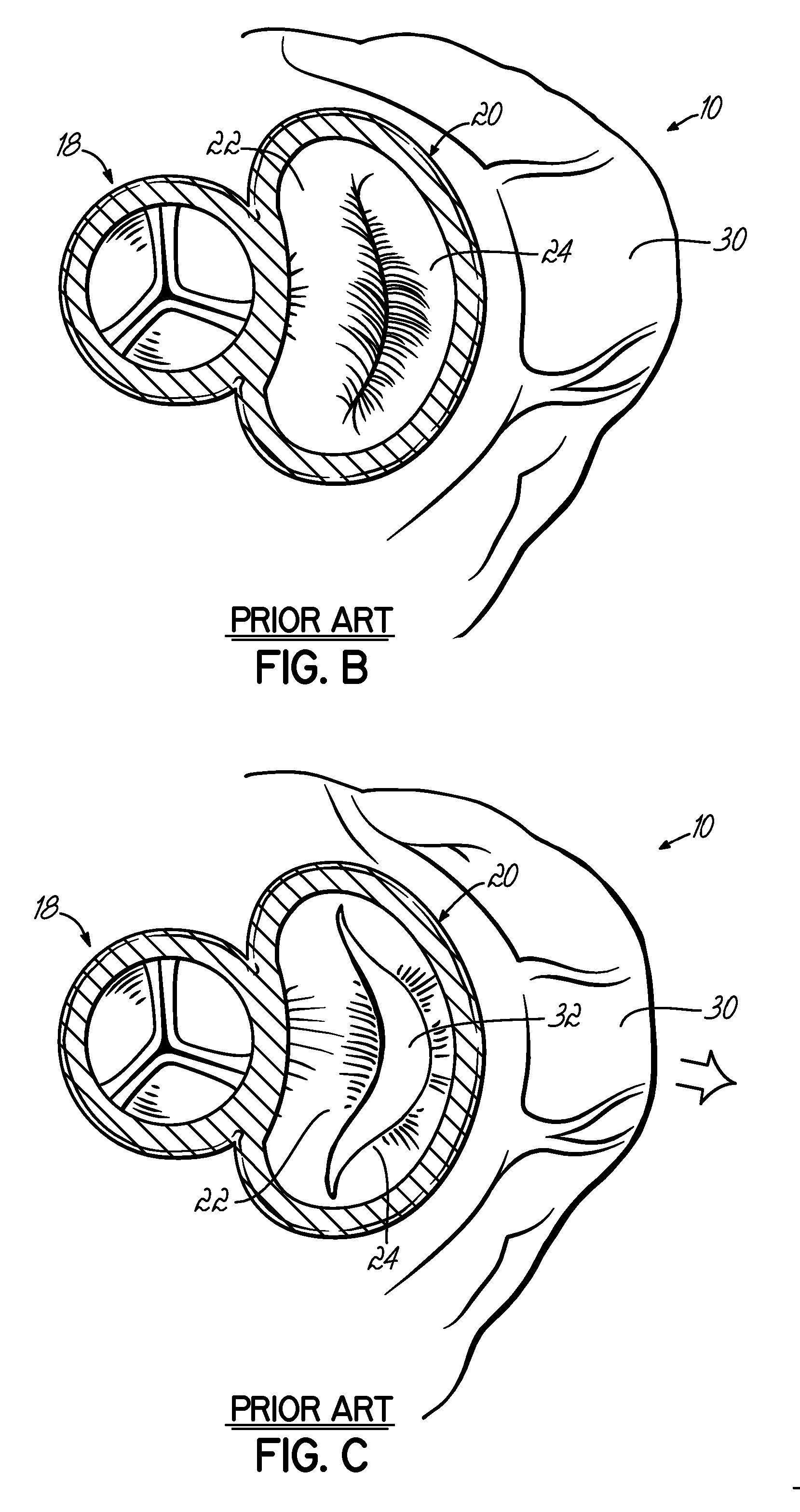 Tissue fastening systems and methods