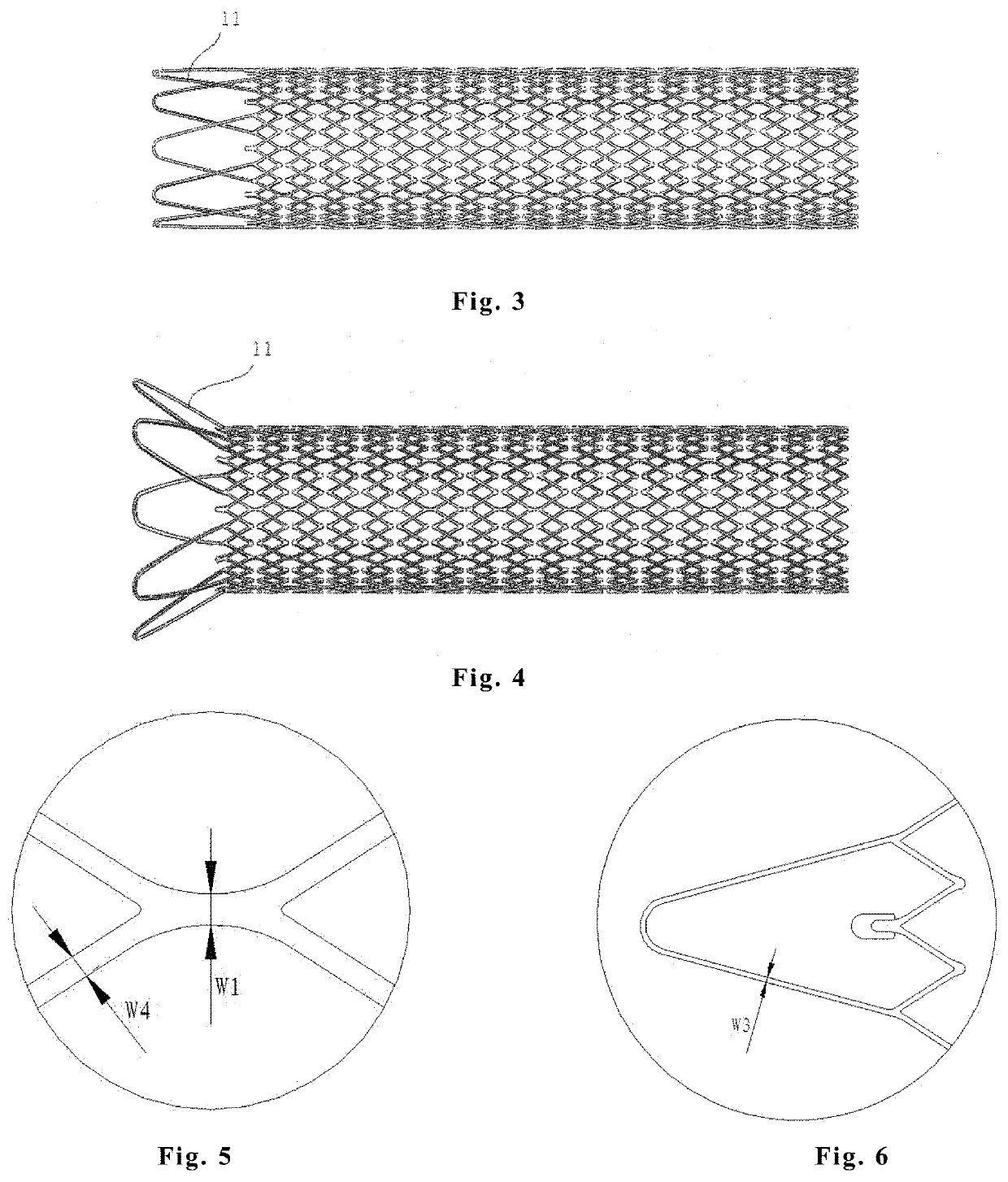 Intravascular stent, preparation method and use thereof