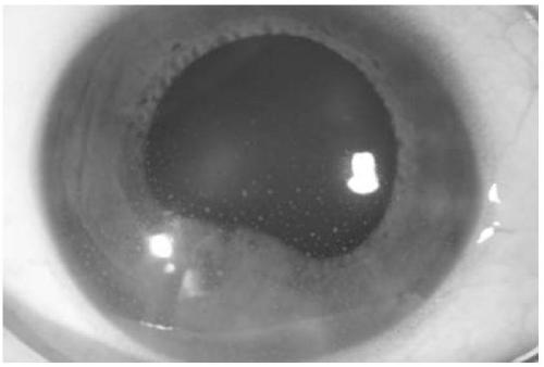 Kit and method for detecting EBV infection in trace biological sample of eye