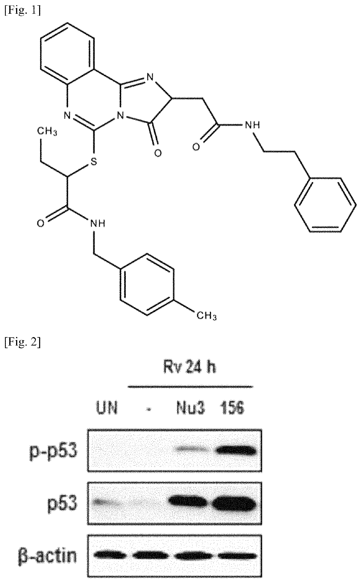 Method for preventing or treating tuberculosis by a P53 expression regulating composition for <i>M. tuberculosis </i>control in cells and the use thereof