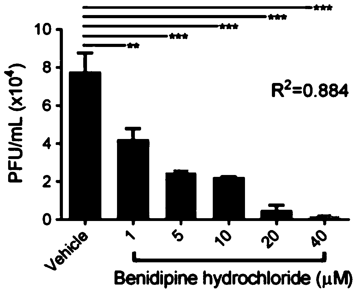 Application of benidipine in preparing drug for preventing and/or treating infectious diseases caused by Bunya viruses