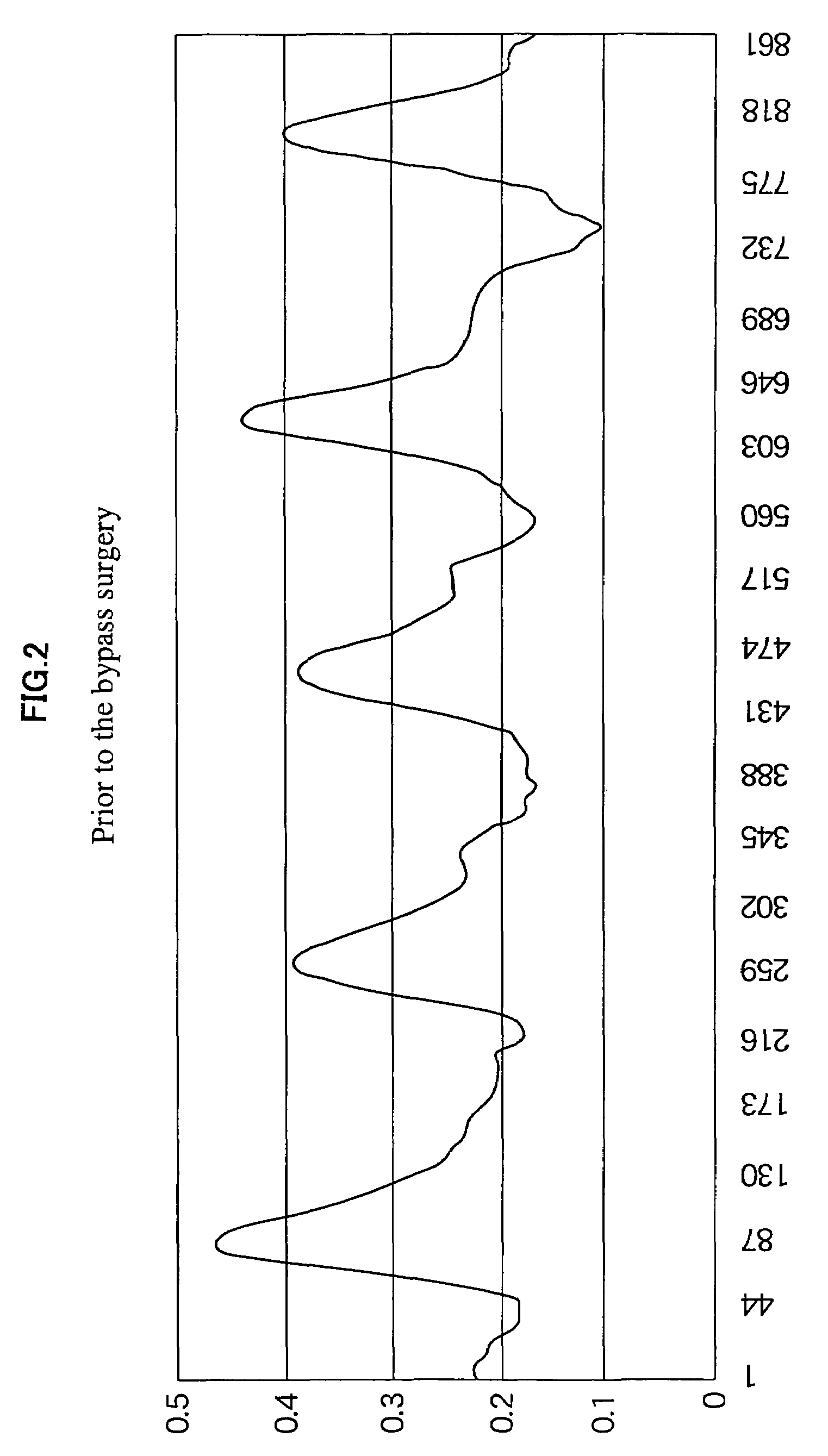 Vascular disease examining system and bypass vascular diagnosing device