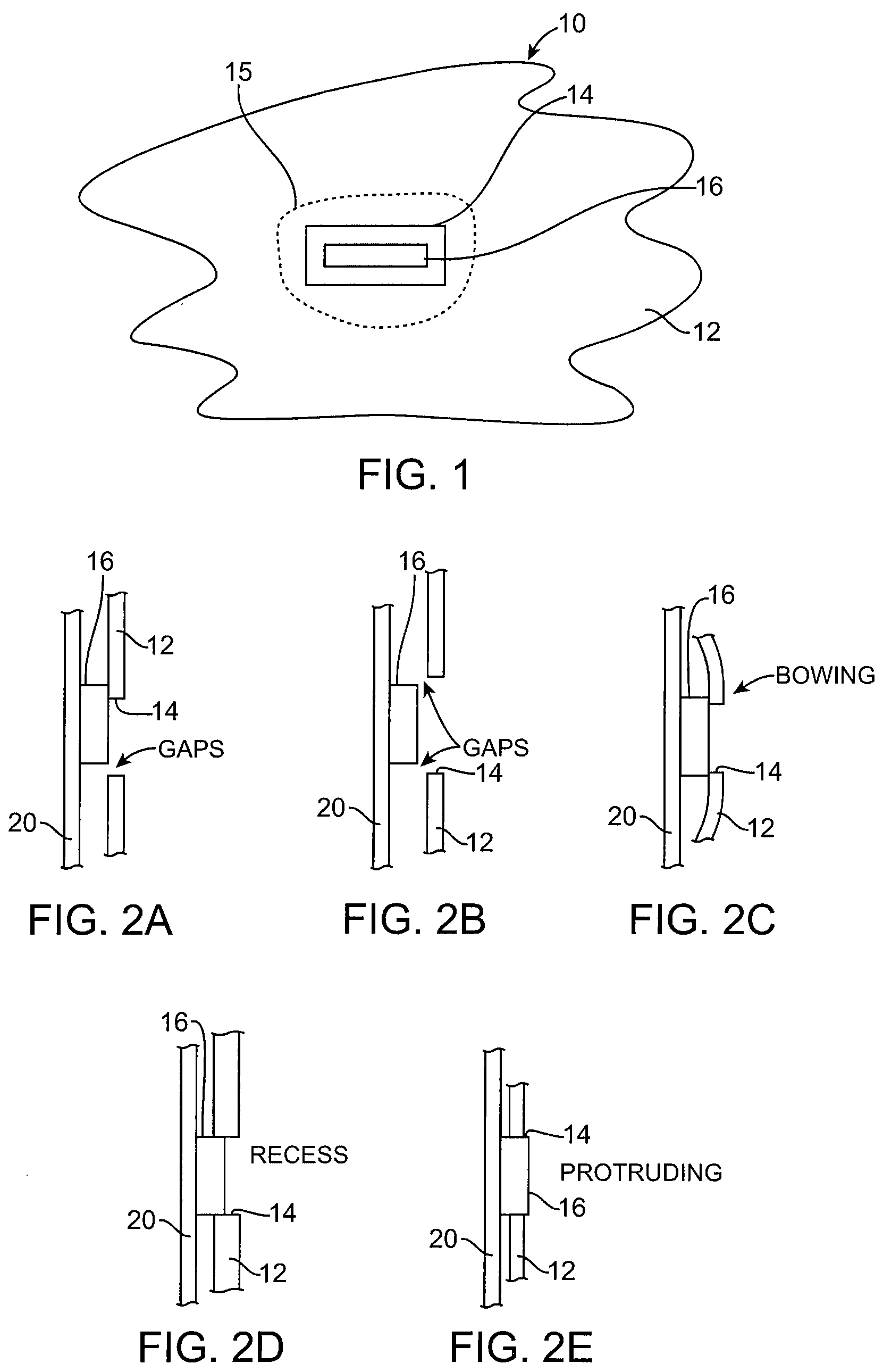 System for coupling interfacing parts