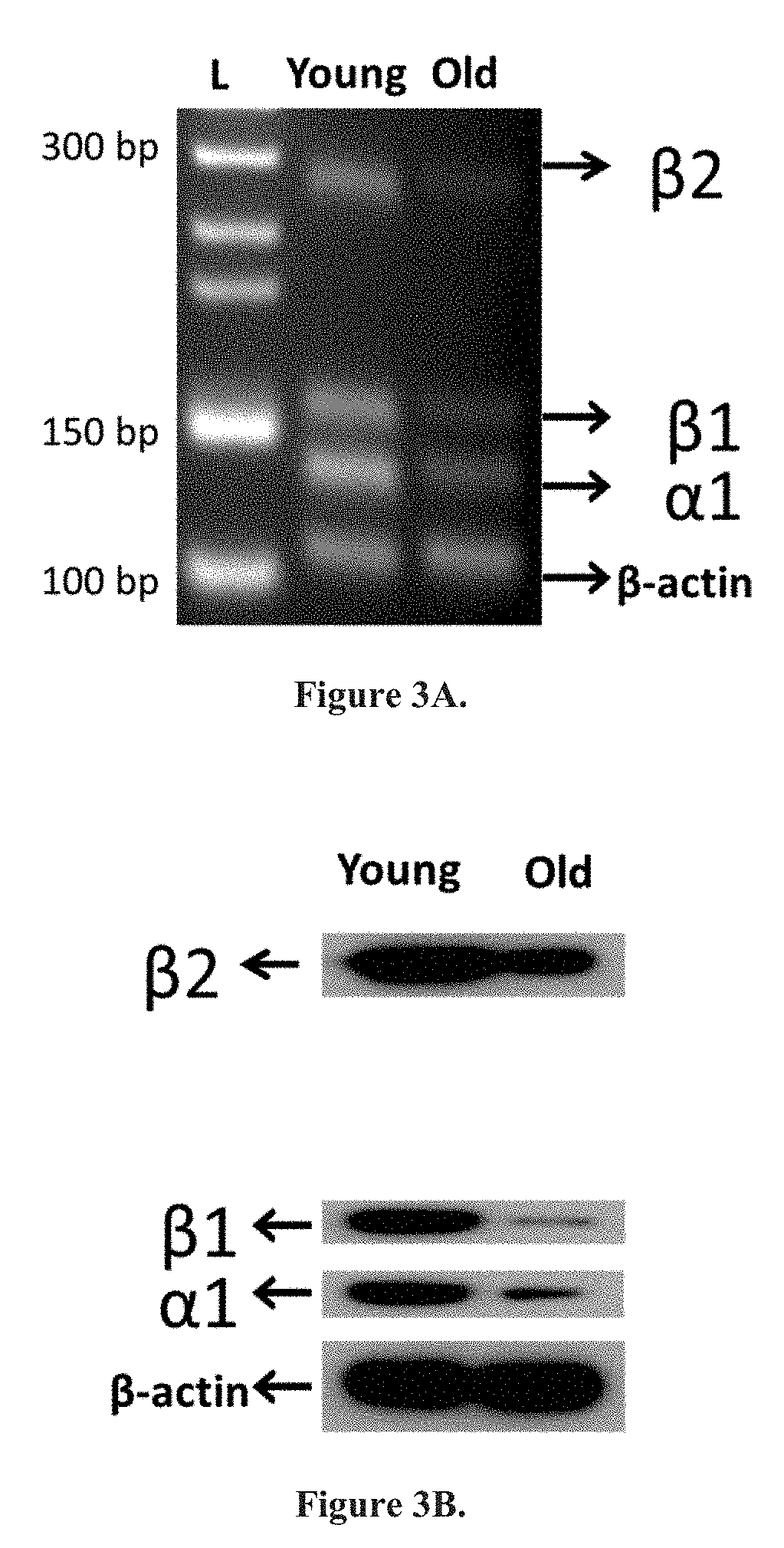 Hormone treatment for age-related hearing loss-presbycusis