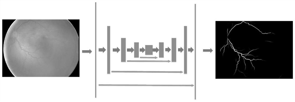 Classification of retinopathy of prematurity plus lesions