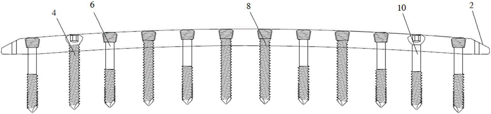 Thighbone front side straight locking plate